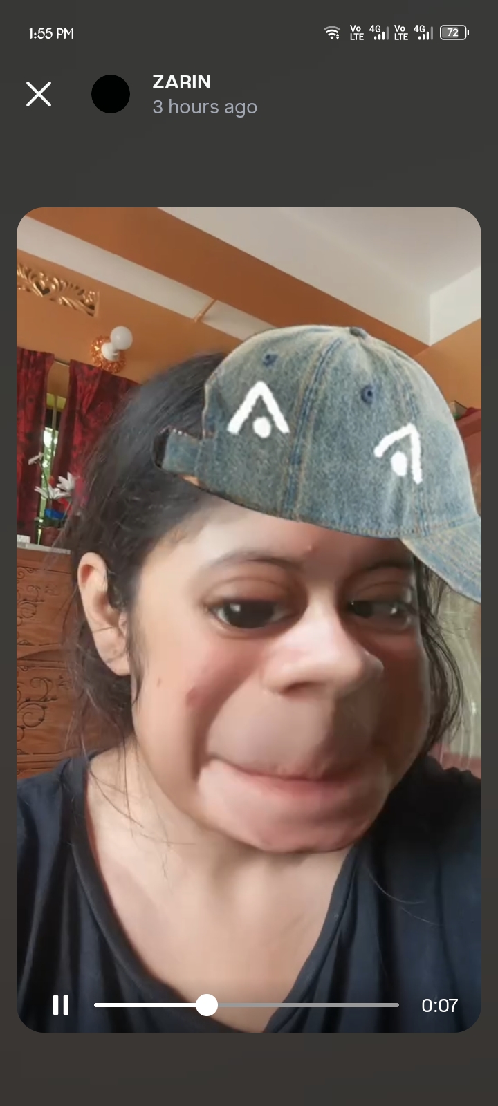Funny surprised face
